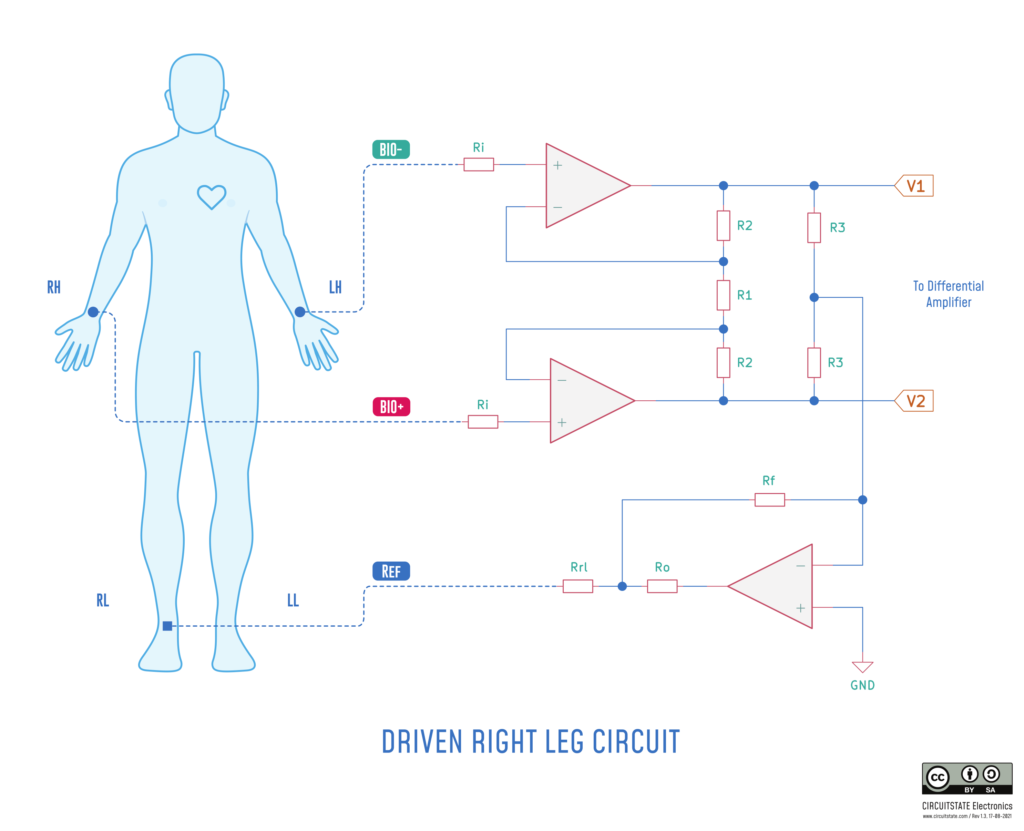 Driven Right Leg Circuit for ECG Measurement - Illustration by CIRCUITSTATE Electronics. CC-BY-SA